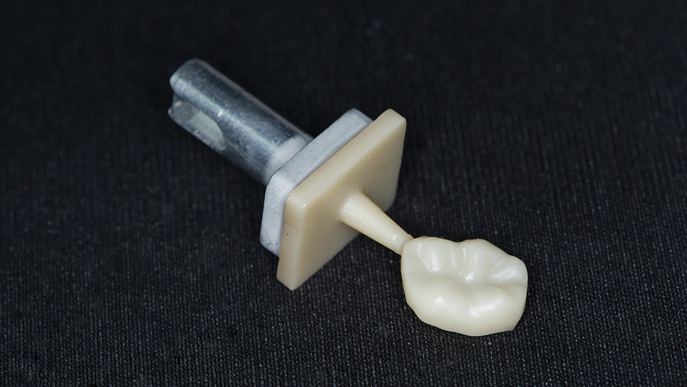 Figure 11: The milled BruxZir NOW crown can be seated directly after milling; however, for this case I decided to add custom staining.