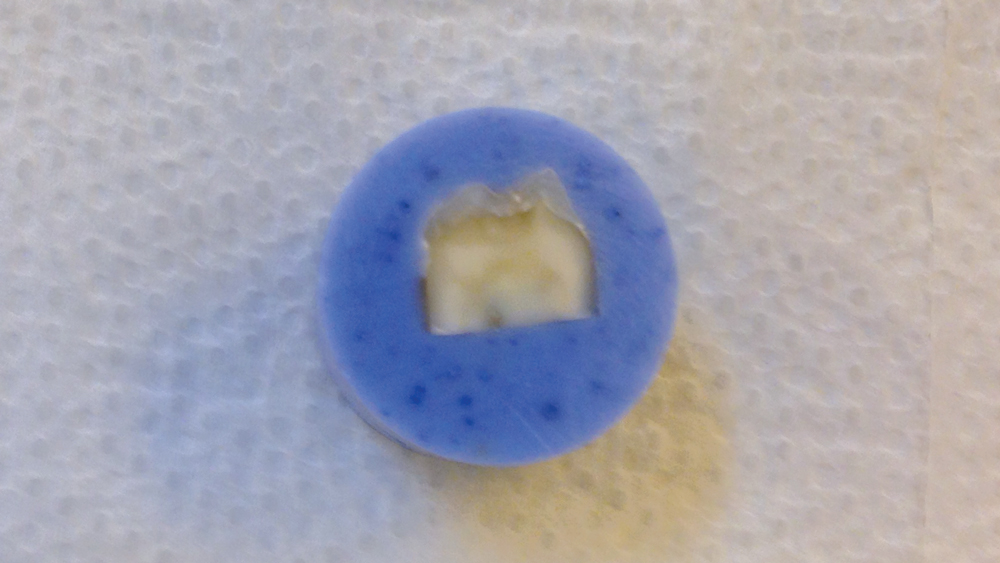 Tooth surface preparation