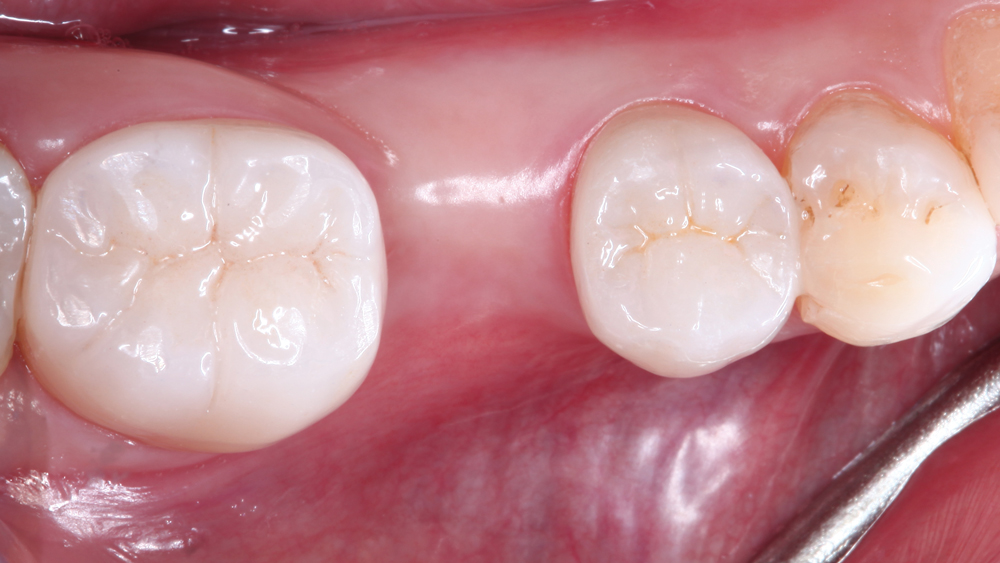 Top view of teeth
