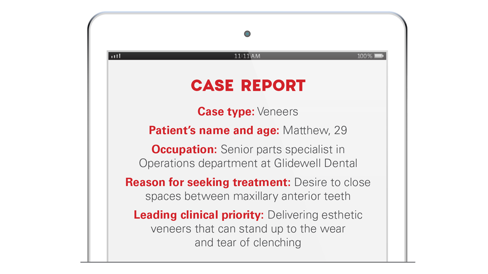 Case report for patient Matthew for veneer treatment