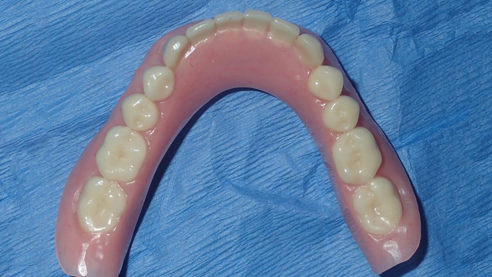 denture fabricated for surgical appointment