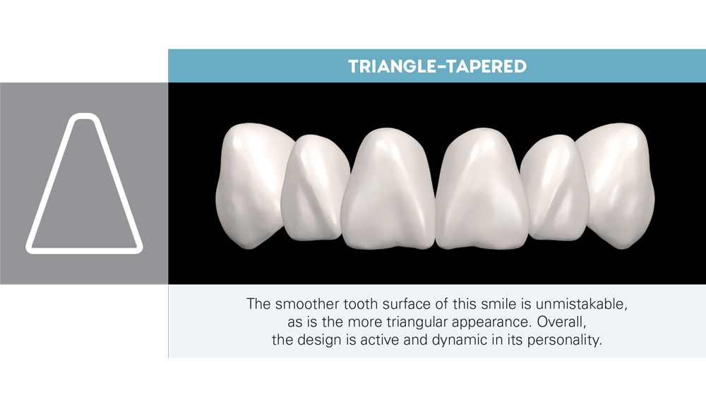 triangle-tapered smile design