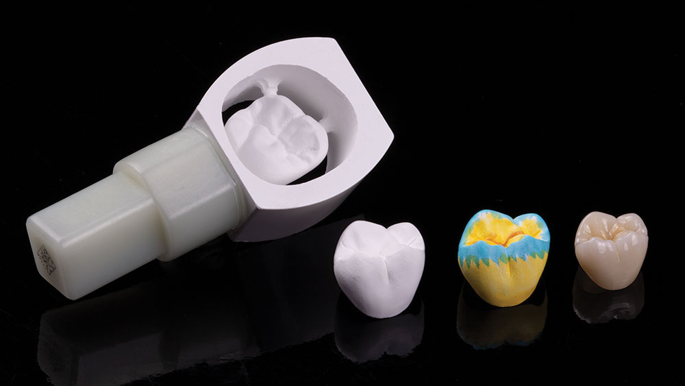 A BruxZir Solid Zirconia block next to other crowns