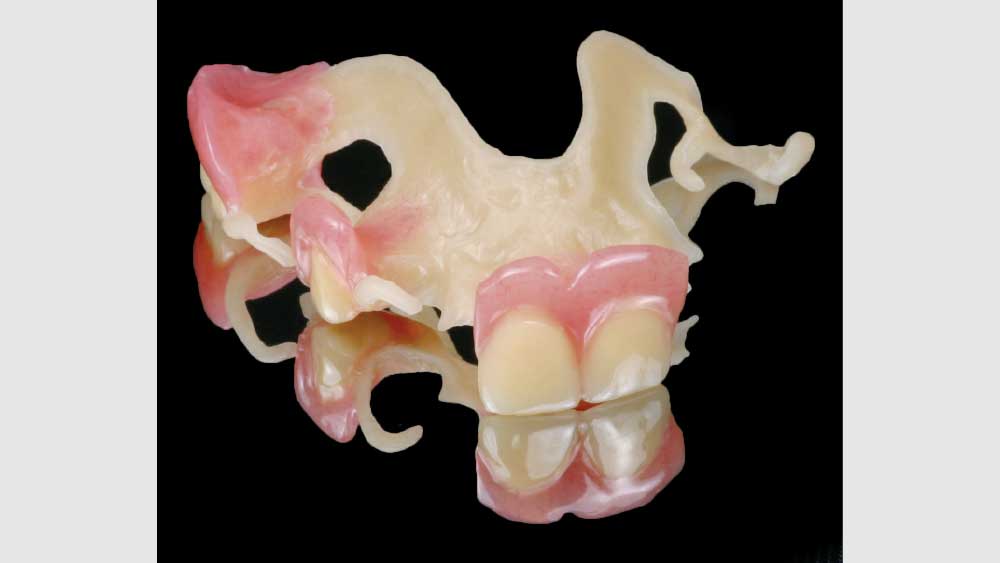 denture teeth with acrylic gingiva