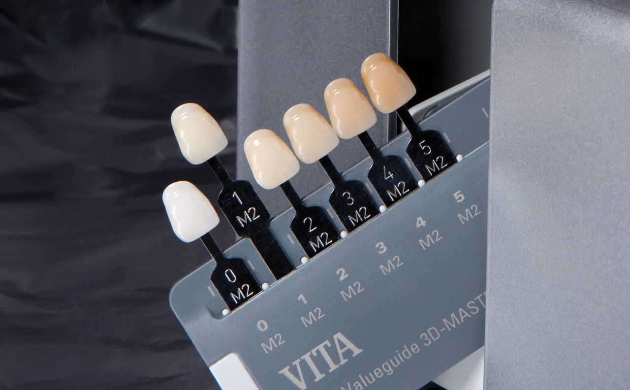 Dr. DiTolla’s Clinical Tips – VITA Linearguide 3D-Master®