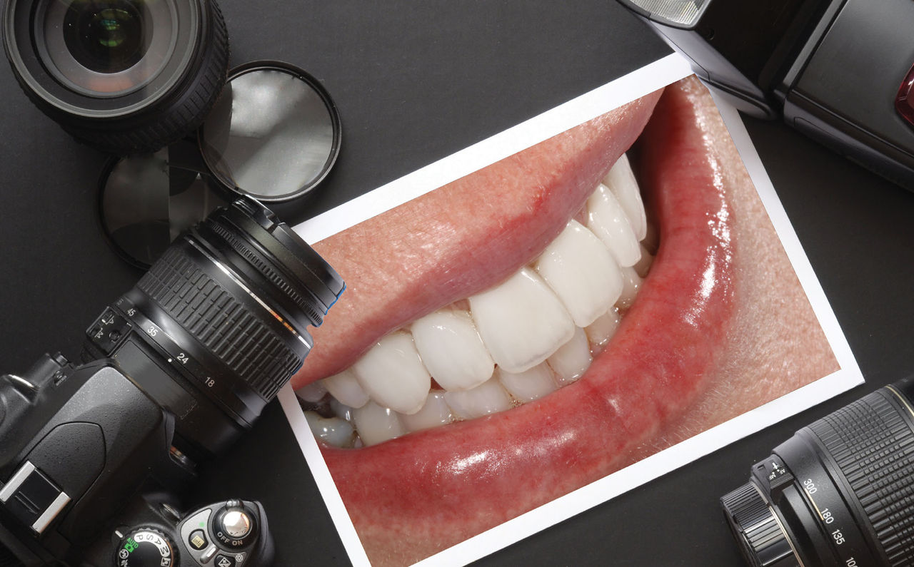 Dental Photography: A New Perspective