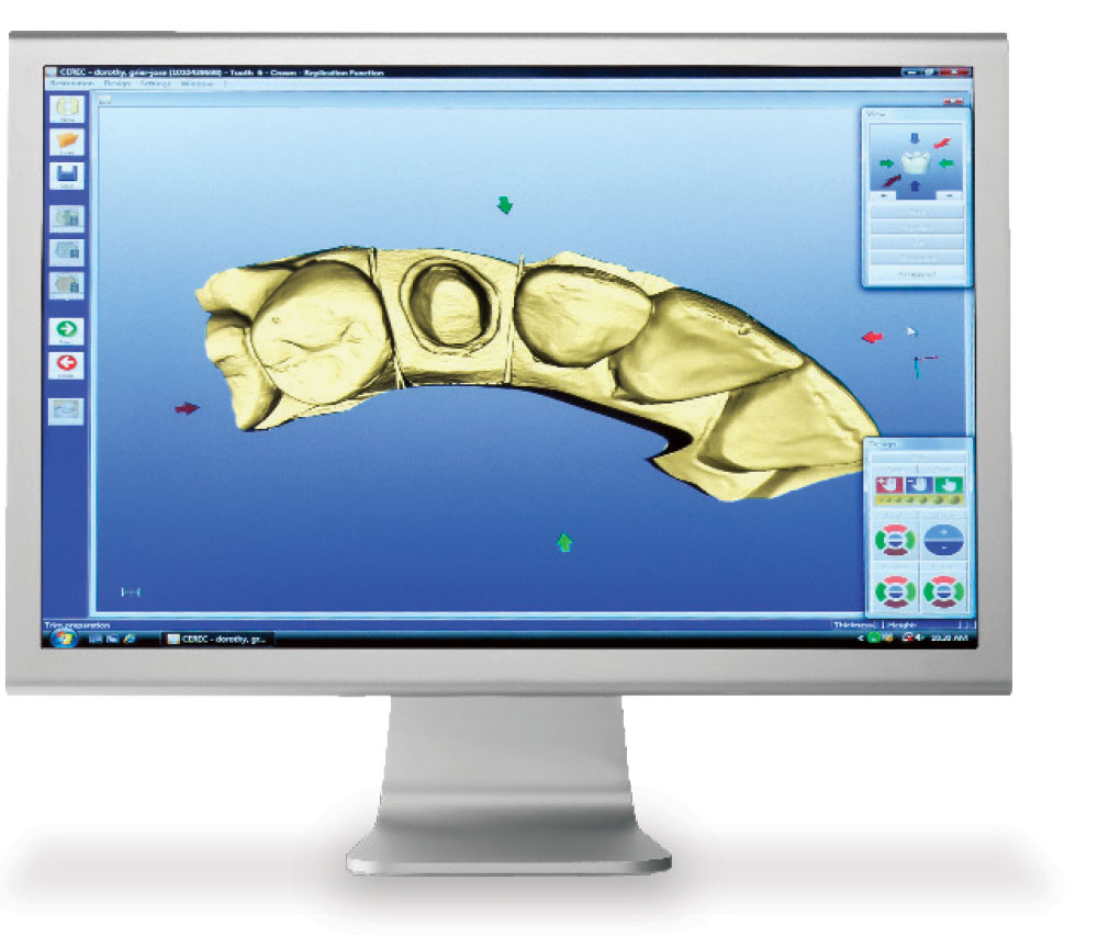 Screen with teeth scan