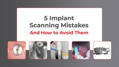 5 Intraoral Scanning Mistakes that Lead to Implant Remakes (And How to Prevent Them) image