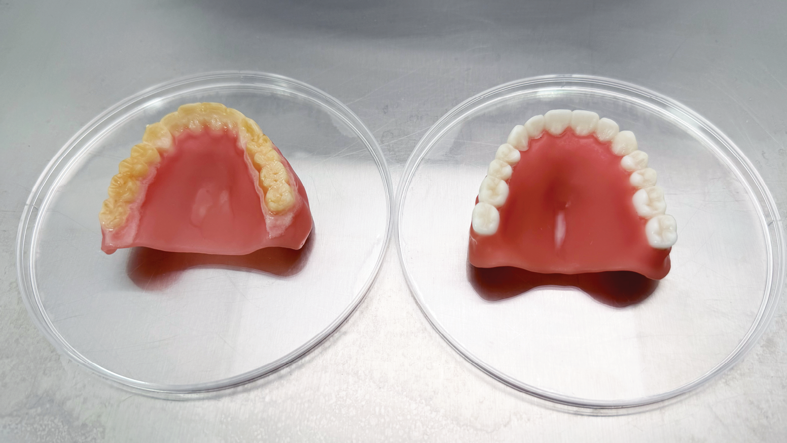 Battling Biofilm: How Antimicrobial Denture Resins Help Safeguard Patient Health