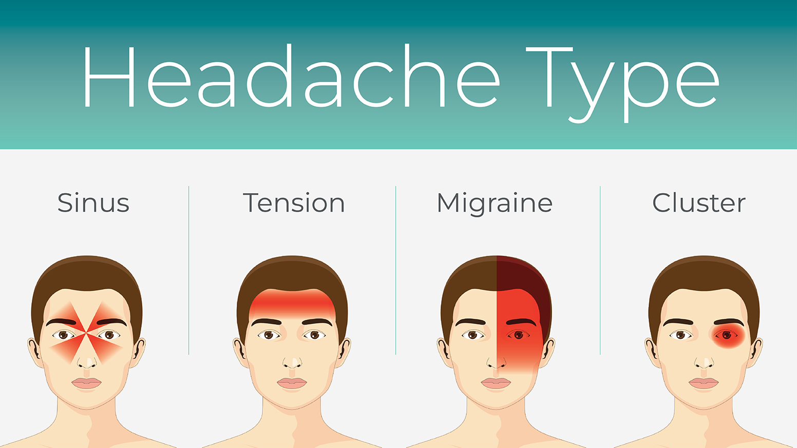 What Is a Migraine Headache? 