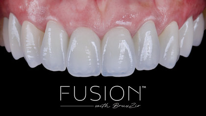 Fusion with BruxZir™ Zirconia: Restorations that Mimic Nature Perfectly  image