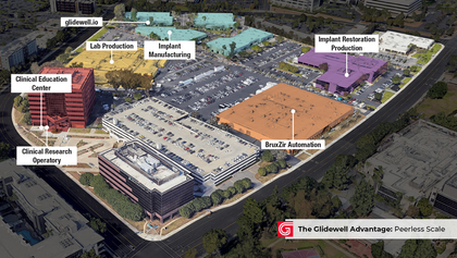 Peerless Scale: How Glidewell’s Unmatched Size Benefits Dentists image