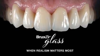 How to Get More Realistic Results for Your Next Smile Transformation image