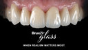 How to Get More Realistic Results for Your Next Smile Transformation image