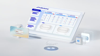 The Profitability Potential of Glidewell™ Clear Aligners: Powered by ProMonitoring™ image