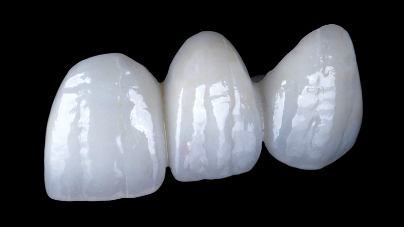 BruxZir® Radiant - Product Image image