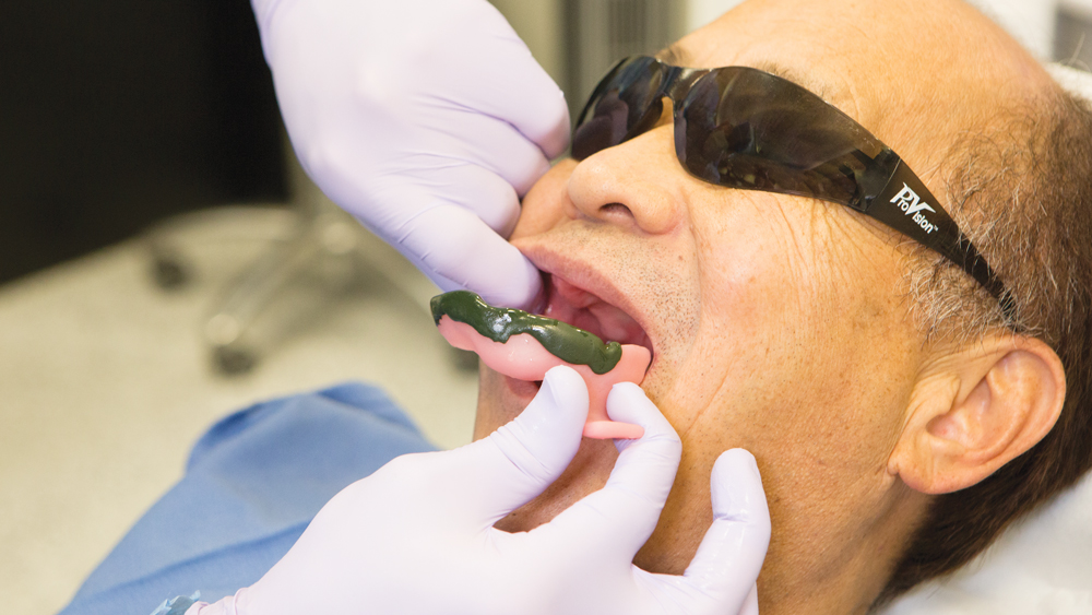 Dental impression procedure