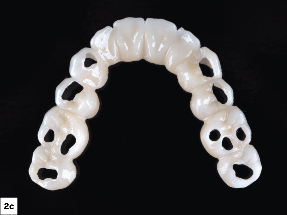 Test-Drive Future Treatment with Smile Transitions™