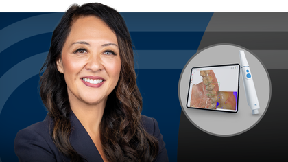 AI in Digital Dentistry: Smarter Imaging, Scanning, and Same-Day Milling image