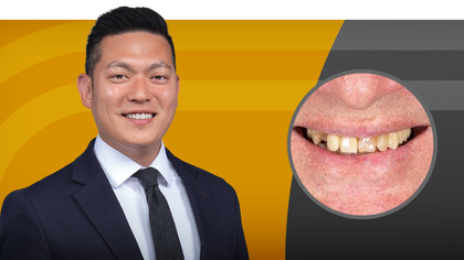 Restorative Material Options for Esthetic Cases  image