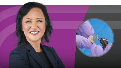 Finishing, Polishing and Cementing Monolithic Zirconia Crowns image
