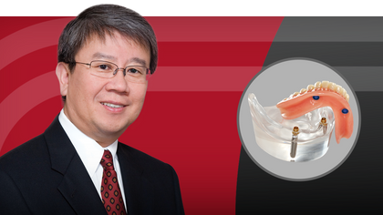 Complete Dentures Part 4: Room for Improvement with Raymond Choi Hero image