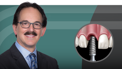 Mastering the Single-Tooth Implant hero image image