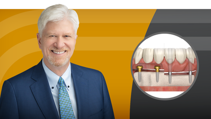 Lock in Success: A Complete Guide to Locator Restorations Part 2 image