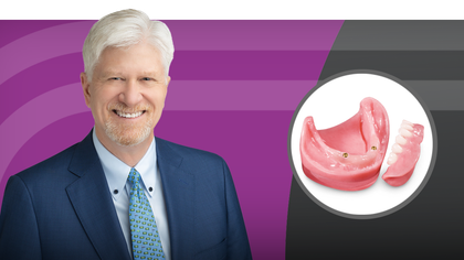 Lock in Success: A Complete Guide to Locator Restorations Part 1 image