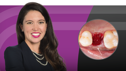 Suturing Techniques: Essential Skills for Optimal Wound Closure image