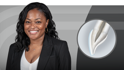Esthetic Veneer Preparations: From No Prep to Full Prep image