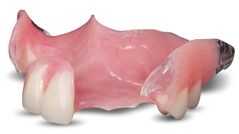 Carrera trolebús Alianza Reflex™ Plus: The most comfortable flexible partial denture!