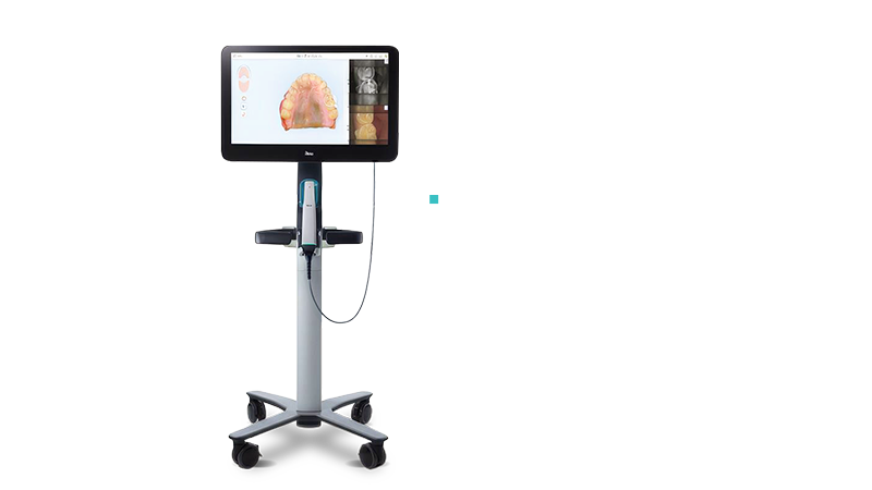 iTero Lumina™ Intraoral Scanner