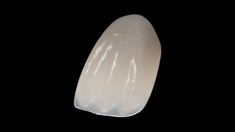 BruxZir® Fusion image