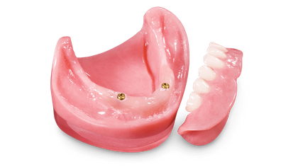 Locator® Overdenture Signature Image image