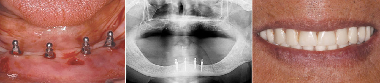 Clinical dentistry images by Ramond Choi, DDS, M.S.