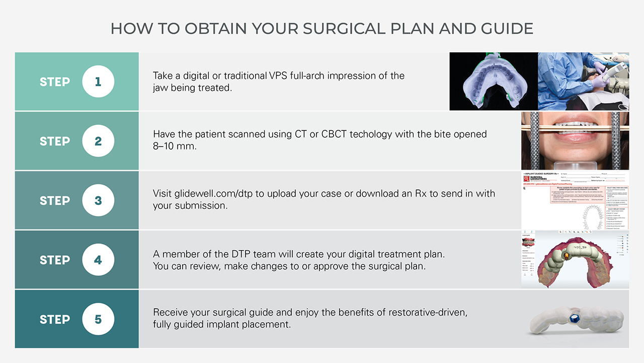 How To Obtain Your Surgical Plan And Guide