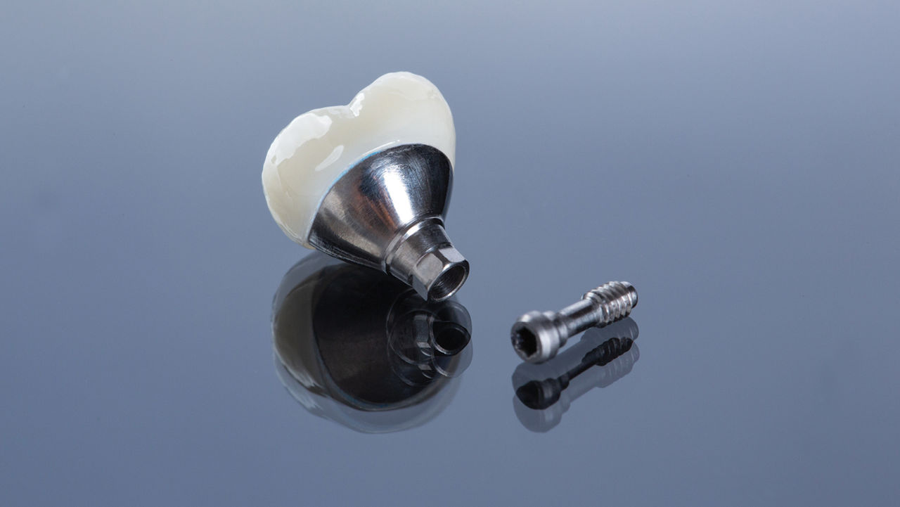 Screwmentable Crowns