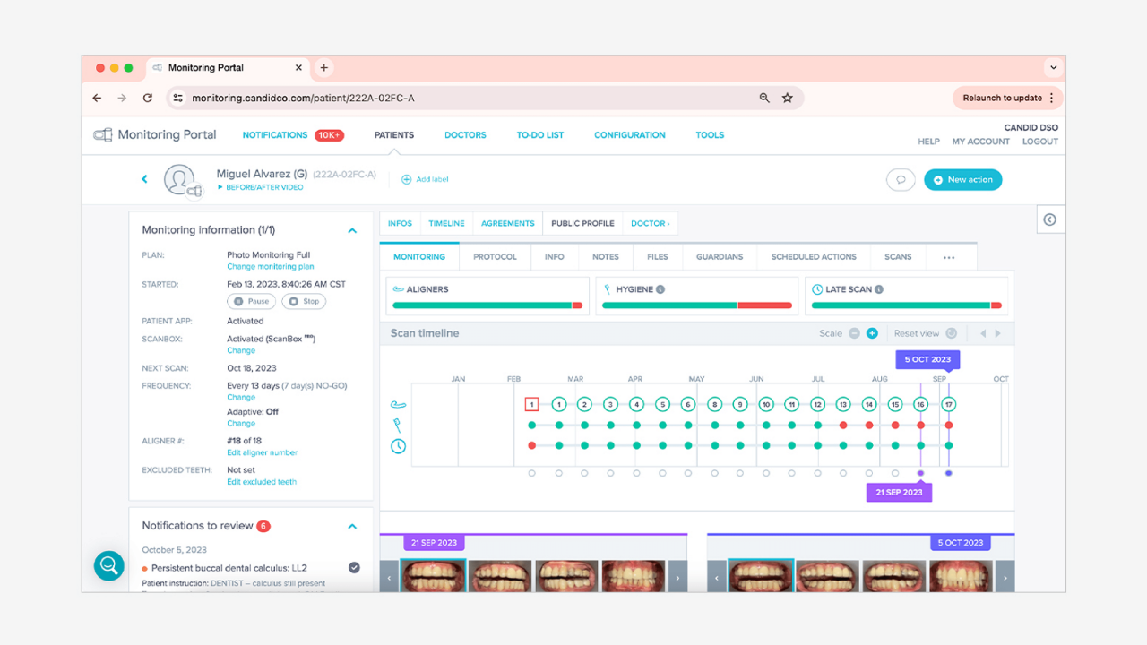 Clear Aligner Monitoring Portal