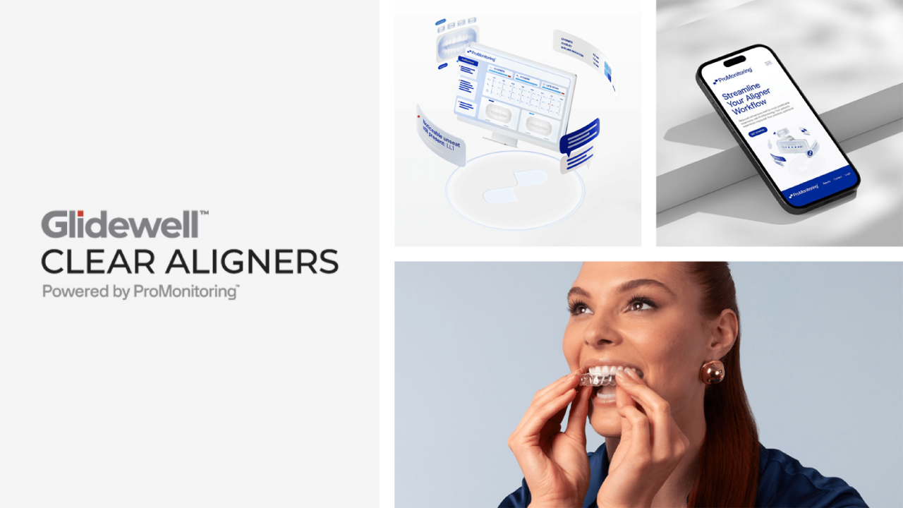 Glidewell Clear Aligners Collage
