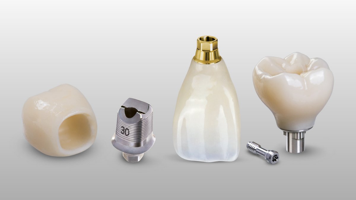 Custom Abutments vs. ScrewRetained Implant Crowns Glidewell