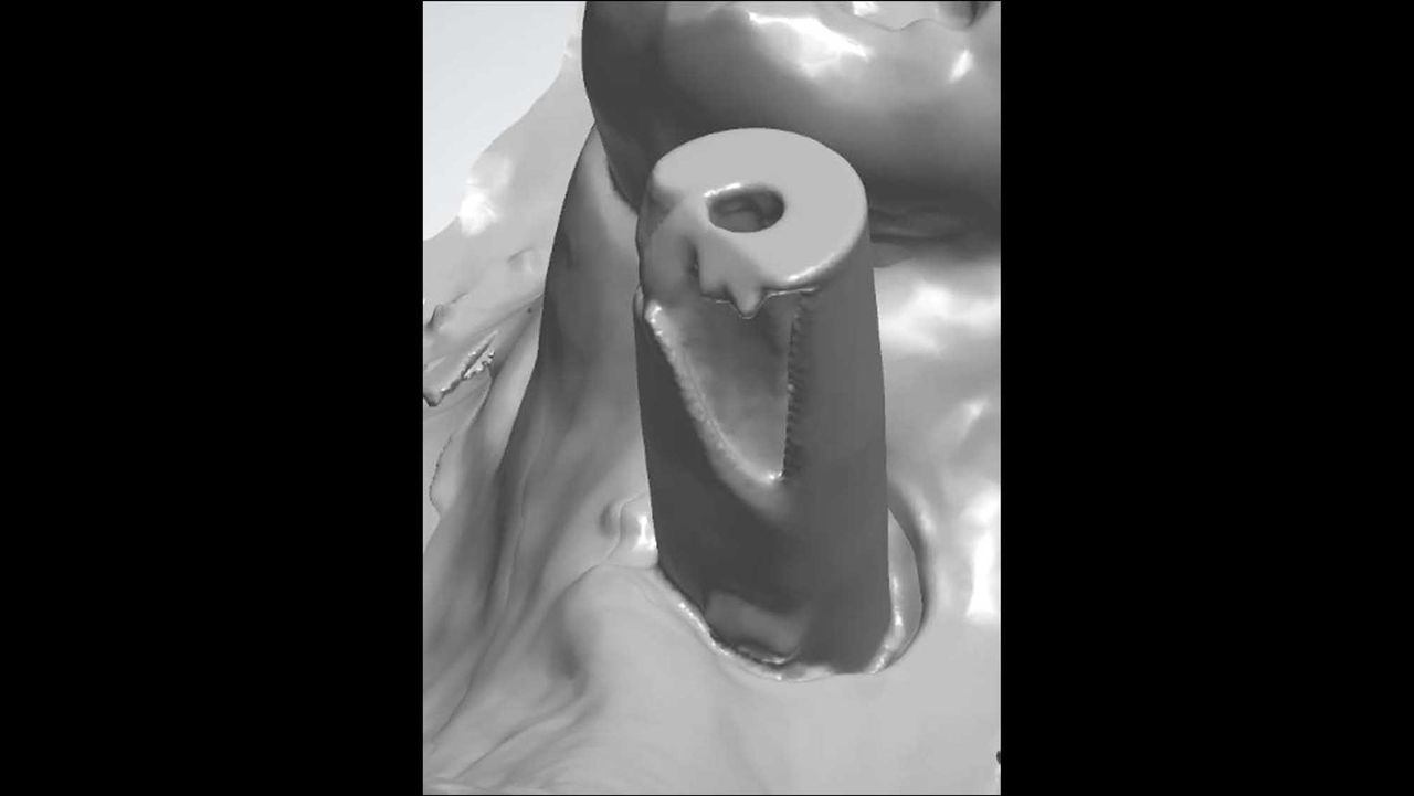 Ready to Take Your Implant Scanning to the Next Level