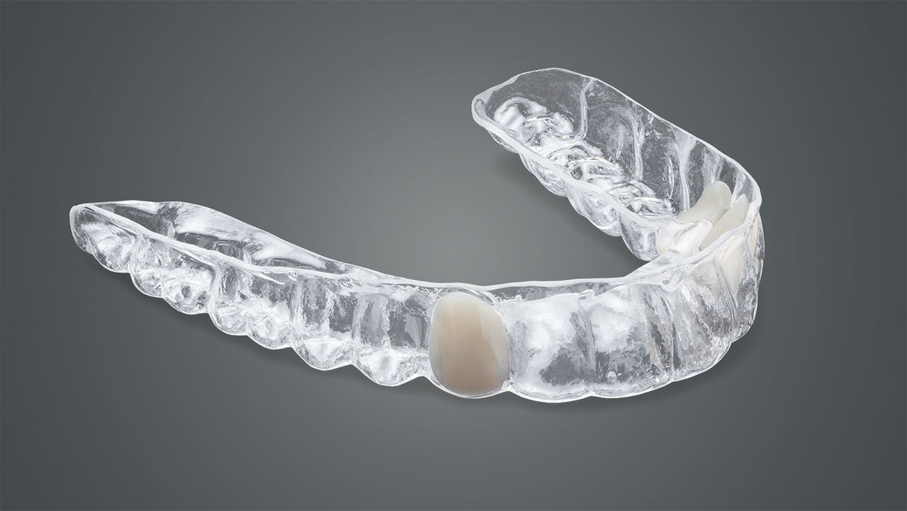 Essix retainer is a clear, vacuum-formed appliance
