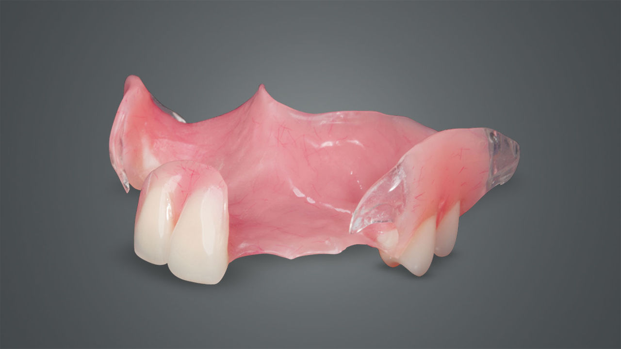 flipper, or acrylic removable partial denture