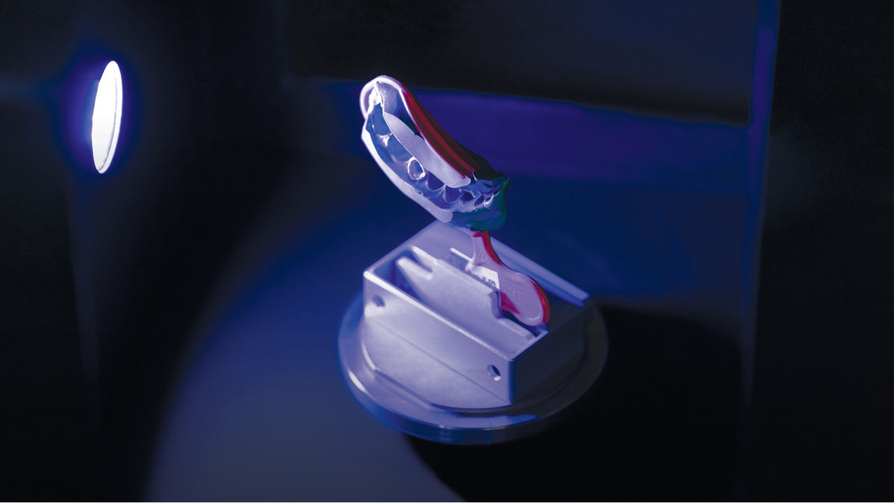 Digital or Physical Impression Intake