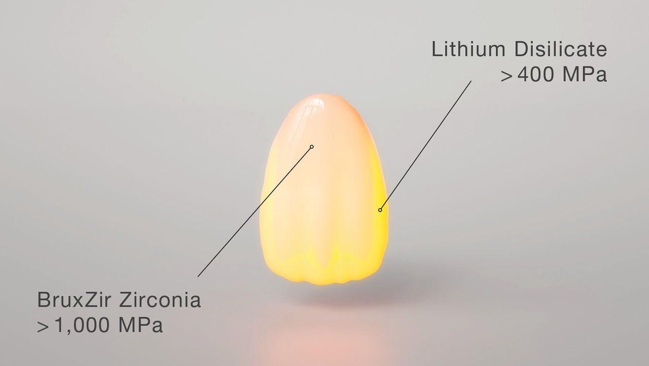 lithium disilicate shell