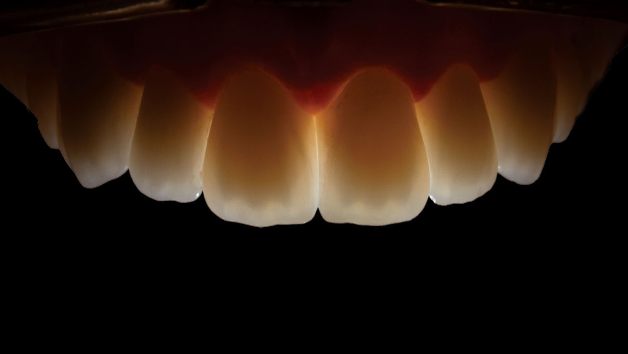 Wraparound-Translucency