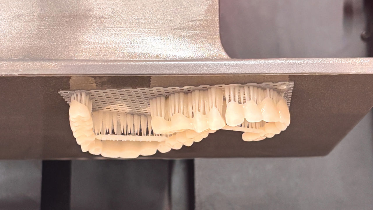 the teeth can be printed in one of 15 VITA shades, and the gingiva in one of three shades