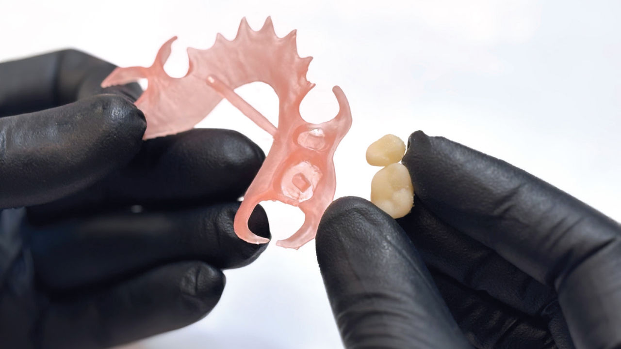 The base and teeth are bonded together and cured to solidify the bond and maximize strength