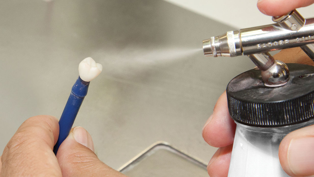 How Dental Crowns Were Traditionally Glazed